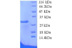 SDS-PAGE (SDS) image for ATPase, H+/K+ Exchanging, beta Polypeptide (ATP4b) (AA 58-291), (Extracellular) protein (His tag) (ABIN5713266) (ATP4b Protein (AA 58-291, Extracellular) (His tag))