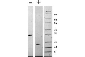 SDS-PAGE of Human Glial Derived Neurotrophic Factor Recombinant Protein SDS-PAGE of Human Human Glial Derived Neurotrophic Factor Recombinant Protein.