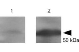 Western blot using  Anti-tetanus toxin C antibody shows detection of a protein band at 52 kDa corresponding to full length 6X HIS-TTFC fusion protein (arrowhead). (Tetanus Toxin C-Fragment (TTC) 抗体)