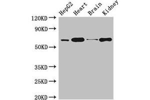 Western Blot Positive WB detected in: HepG2 whole cell lysate, Mouse heart tissue, Mouse brain tissue, Mouse kidney tissue All lanes: HNRNPL antibody at 3 μg/mL Secondary Goat polyclonal to rabbit IgG at 1/50000 dilution Predicted band size: 65, 51 kDa Observed band size: 65 kDa (HNRNPL 抗体  (AA 89-335))
