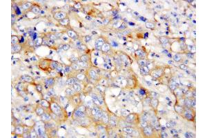 Immunohistochemistry (IHC) image for anti-Platelet Factor 4 (PF4) (AA 85-101), (C-Term) antibody (ABIN3043213)
