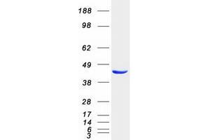 ACOT1 Protein (Myc-DYKDDDDK Tag)