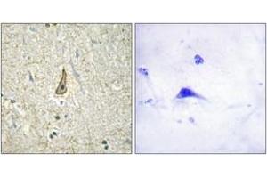 Immunohistochemistry analysis of paraffin-embedded human brain, using Cytochrome P450 26C1 Antibody. (CYP26C1 抗体  (AA 41-90))