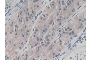Detection of NGAL in Human Stomach Tissue using Monoclonal Antibody to Neutrophil gelatinase-associated lipocalin (NGAL) (Lipocalin 2 抗体  (AA 21-198))