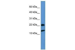 RPS27A antibody used at 0. (RPS27A 抗体  (Middle Region))