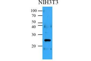 Western Blotting (WB) image for anti-B-Cell CLL/lymphoma 2 (BCL2) antibody (ABIN567617) (Bcl-2 抗体)