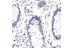 Immunohistochemistry of paraffin-embedded human colon using H3R2me2a antibody.