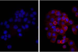 Human pancreatic carcinoma cell line MIA PaCa-2 was stained with Mouse Anti-Human CD44-UNLB, and DAPI. (驴 anti-小鼠 IgG (Heavy & Light Chain) Antibody (PE) - Preadsorbed)