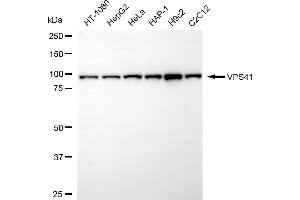 Western blotting analysis using VPS41 antibody (ABIN7800815). (Recombinant VPS41 抗体)