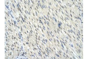 Rabbit Anti-KLF10 antibody        Paraffin Embedded Tissue:  Human Heart cell   Cellular Data:  Epithelial cells of renal tubule  Antibody Concentration:   4. (KLF10/TIEG1 抗体  (C-Term))