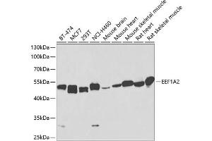 Western blot analysis of extracts of various cell lines, using EEF1 antibody (473) at 1:1000 dilution. (EEF1A2 抗体  (AA 184-463))