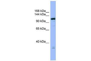 FAM29A antibody used at 1 ug/ml to detect target protein. (FAM29A 抗体  (Middle Region))