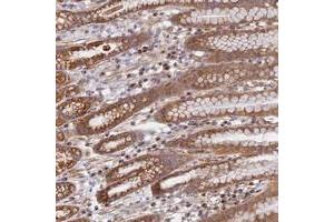 Immunohistochemical staining of human stomach with DDA1 polyclonal antibody  shows moderate cytoplasmic positivity in glandular cells at 1:50-1:200 dilution. (DDA1 抗体)
