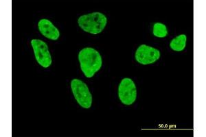 Immunofluorescence of purified MaxPab antibody to HNRNPL on HeLa cell. (HNRNPL 抗体  (AA 1-558))