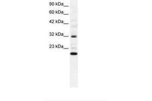 Image no. 1 for anti-rho GDP Dissociation Inhibitor (GDI) gamma (ARHGDIG) (AA 42-90) antibody (ABIN6735819) (ARHGDIG 抗体  (AA 42-90))