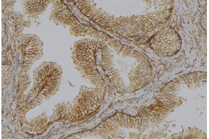 ABIN6278644 at 1/100 staining Mouse colon tissue by IHC-P. (TMPRSS3 抗体  (Internal Region))