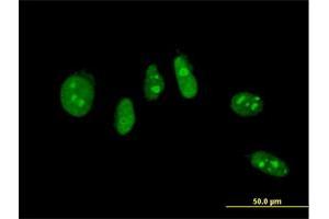 Immunofluorescence of monoclonal antibody to NHLH2 on HeLa cell. (NHLH2 抗体  (AA 36-135))