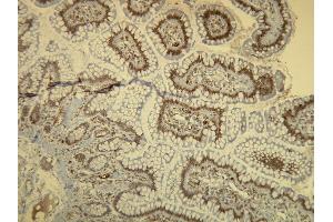 Immunohistochemistry (IHC) image for anti-B-Raf proto-oncogene, serine/threonine kinase (BRAF) antibody (ABIN7598779)