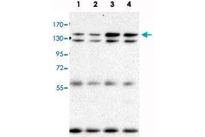Immunoprecipitation and Western blot analysis in Lane 1: parental BaF3 cells, Lane 2: BaF3+BCR-ABL (BaF3 cells transduced with BCR-ABL), Lane 3: BaF3+BCR-ABL+mAhi-I (M1, BaF3 cells transduced with both BCR-ABL and mouse Ahi-1, M1 is a clonal cell line), Lane 4: BaF3+BCR-ABL+mAhi-1 (C2, BaF3 cells transduced with both BCR-ABL and mouse Ahi-1, C2 is a clonal cell line) with Ahi1 monoclonal antibody, clone 645s3 . (AHI1 抗体  (C-Term))