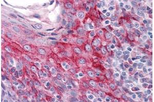 Human Tonsil: Formalin-Fixed, Paraffin-Embedded (FFPE) (ZMYM4 抗体  (C-Term))