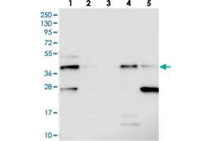 Western blot analysis of Lane 1: RT-4, Lane 2: U-251 MG, Lane 3: Human Plasma, Lane 4: Liver, Lane 5: Tonsil with C19orf66 polyclonal antibody  at 1:250-1:500 dilution. (C19ORF66 抗体)