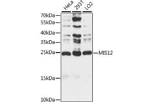 Western blot analysis of extracts of various cell lines, using MIS12 antibody (ABIN7268546) at 1:1000 dilution. (MIS12 抗体  (AA 1-205))