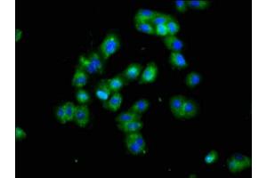 Immunofluorescence staining of HepG2 cells with ABIN7165254 at 1:100, counter-stained with DAPI. (DLK1 抗体  (AA 24-303))