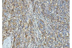 IHC analysis of ICAM1 using anti-ICAM1 antibody (ABIN7601066). (ICAM1 抗体  (AA 28-268))
