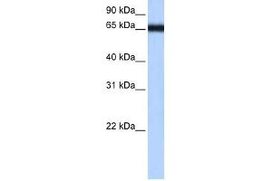 ZNF14 antibody used at 0. (ZFP14 抗体  (N-Term))