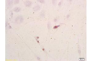 Neuroblastoma cells labeled with Anti-NSE/ENO2/? (ENO2/NSE 抗体  (AA 201-300))