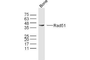 Mouse bone lysates probed with Rad51 Polyclonal Antibody, Unconjugated  at 1:300 overnight at 4˚C. (RAD51 抗体  (AA 81-180))