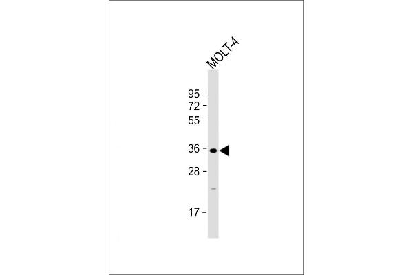 GLT6D1 anticorps  (AA 100-133)