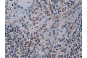 Immunohistochemistry (IHC) image for anti-Family with Sequence Similarity 3, Member C (FAM3C) (AA 25-227) antibody (ABIN7443470)