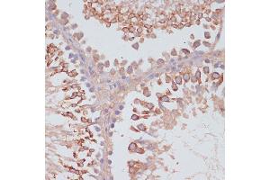 Immunohistochemistry of paraffin-embedded rat testis using MRPL41 antibody (ABIN7268572) at dilution of 1:100 (40x lens). (MRPL41 抗体  (AA 1-137))