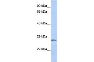 WB Suggested Anti-SFRP2 Antibody Titration: 0. (SFRP2 抗体  (Middle Region))