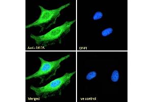 (ABIN334388) Immunofluorescence analysis of paraformaldehyde fixed HeLa cells, permeabilized with 0. (DRD5 抗体  (Internal Region))