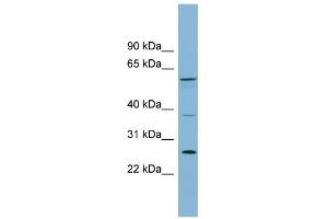 WB Suggested Anti-GDAP2 Antibody Titration: 0. (GDAP2 抗体  (N-Term))