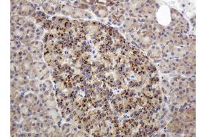 Image no. 5 for anti-Glyceraldehyde-3-Phosphate Dehydrogenase, Spermatogenic (GAPDHS) antibody (ABIN1498375)