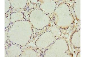 Immunohistochemistry of paraffin-embedded human thyroid tissue using ABIN7156244 at dilution of 1:100 (INHBC 抗体  (AA 103-352))
