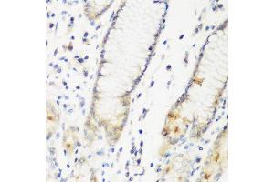 Immunohistochemistry of paraffin-embedded human gastric using DHODH antibody at dilution of 1:200 (40x lens). (DHODH 抗体)