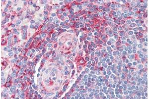 Human Spleen: Formalin-Fixed, Paraffin-Embedded (FFPE) (MVP 抗体  (AA 1-894))