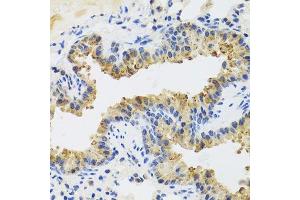 Immunohistochemistry (Paraffin-embedded Sections) (IHC (p)) image for anti-UV Radiation Resistance Associated Gene (UVRAG) (AA 501-699) antibody (ABIN6150044)
