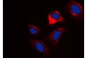 Immunofluorescent analysis of Phospholamban (pS16/T17) staining in HuvEc cells. (Phospholamban 抗体  (N-Term, pSer16, pSer17))