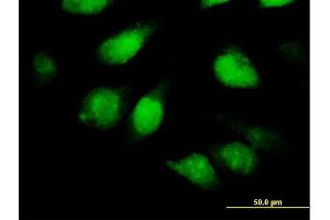 Immunofluorescence of purified MaxPab antibody to TSNAXIP1 on HeLa cell. (Tsnaxip1 抗体  (AA 1-366))