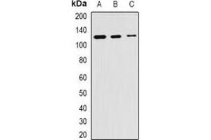 Western blot analysis of SKIV2L2 expression in Hela (A), mouse kidney (B), mouse testis (C) whole cell lysates. (MTR4 抗体)