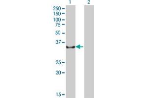 Western Blot analysis of NCR1 expression in transfected 293T cell line ( H00009437-T01 ) by NCR1 MaxPab polyclonal antibody. (NCR1 抗体  (AA 22-303))