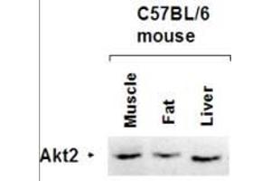 Western Blotting (WB) image for anti-V-Akt Murine Thymoma Viral Oncogene Homolog 2 (AKT2) (AA 450-475) antibody (ABIN94790)