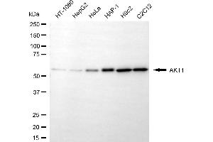 Western blotting analysis using AKT1 antibody (ABIN7800778).