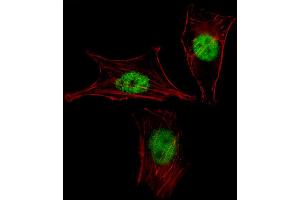Fluorescent image of NIH-3T3 cell stained with MEOX2 Antibody . (MEOX2 抗体  (AA 164-192))