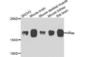 Western blot analysis of extracts of various cell lines, using HRAS antibody. (HRAS 抗体)